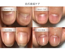 リケアネイル(Re:care nail)
