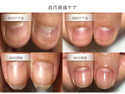 リケアネイル(Re:care nail)の写真