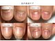 リケアネイル(Re:care nail)の写真