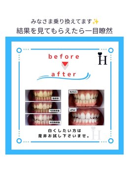 ハピネス 心斎橋アメリカ村本店(Happiness)/赤色LED
