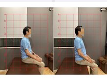 摂津本山駅前鍼灸整骨院/ビフォーアフターになります！