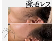 アンドビー(&B)の雰囲気（産毛ケアで顔にメリハリ！化粧とスキンケアのノリが劇的にアップ）