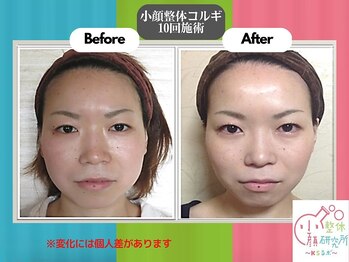 小顔整体研究所 KSラボ 天王寺店/
