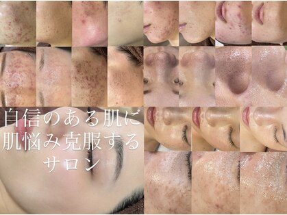 レシェルサロン(Lechelle Salon)の写真