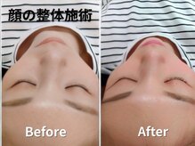 ウィル(will)/顔の整体｜美容鍼灸サロンwill