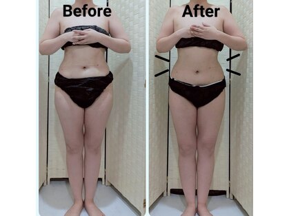 ヨサパーク ラプラス(YOSA PARK Laplace)の写真