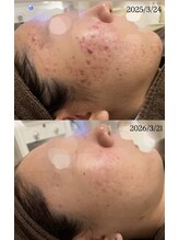 ハーブのほし/1年でこんなに綺麗に