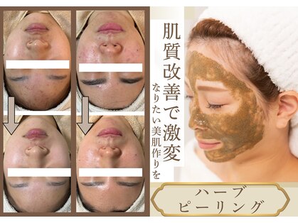 ルーセントの写真
