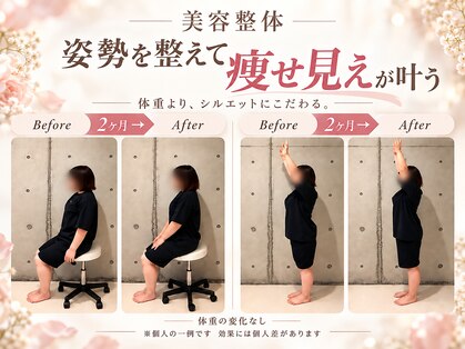 イッキュウ(ikkyu)の写真