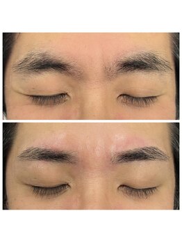 ブロウズ 新橋店(BROWS)/施術例