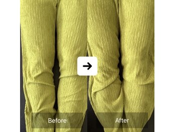 ナオル整体 三宮院(NAORU整体)/40代女性整体事例【O脚】