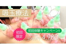 横浜シードはり灸 マッサージ治療院 シードジム(SEED GYM)の雰囲気（人気のカッピングコースあります☆初回キャンペーン中）