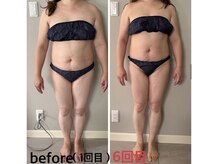 ティアラ(TIARA)/痩身