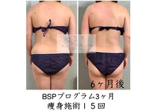 アイ エステサロン(Ai)/【40代】腰回り・お腹・全体的に