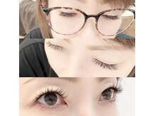 フィーネ ヴァレンテ アルプス通り店/＊施術イメージ＊