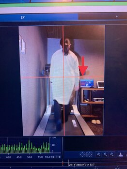 メディカルジャパン 吉祥寺/歩行でわかる動きの癖