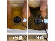 フォーケア(4Care)の雰囲気(デトックスフットバス 老廃物排出 冷え症 浮腫 )