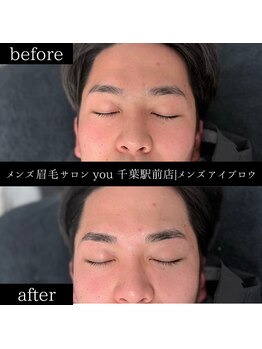 ユー 千葉駅前店(you)/ビフォ－アフター写真
