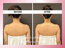 リスブランビューティー(Lys Blanc Beauty)/９０分コルギBefore×After