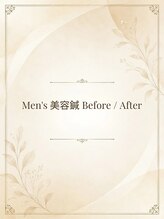 長寿鍼灸院 長寿整骨院/men's美容鍼実例