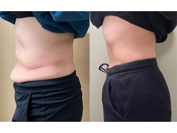 ココア(CoCoa)/トレーニング×最新マシン