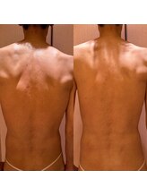 凪 横浜/浮腫み、凝りをスッキリ！