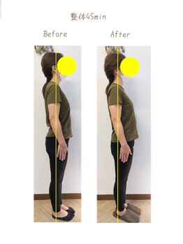 ボディケア メロー(bodycare mellow)/整体ビフォーアフター