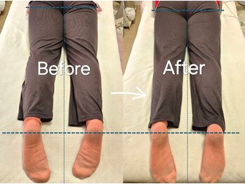 スノー シャイン(SNOW SHINE)/【Before→After】