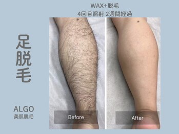 アルゴ 山口宇部店(ALGO)/即日でここまで綺麗に!