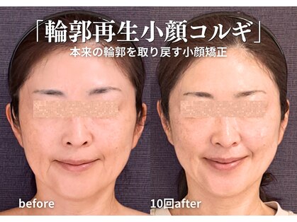 バンブー(bamboo)の写真