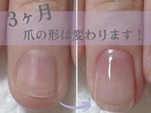 アメジスト(Amethyst)の雰囲気（深爪・爪の悩み専門店です！3ヶ月後の変化をお楽しみに♪）