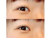 ルアナ(LUANA)/ラッシュリフト