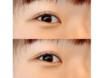 ルアナ(LUANA)/ラッシュリフト