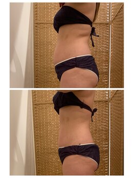 フラウラ(Fraula)/初回から比較