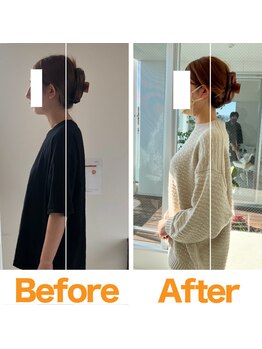 整体院ひなた 都城院/ストレートネック改善!!