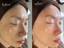 サロン ベレ プー(Salon Belle Peau)/before/after