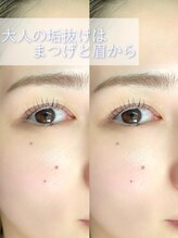 キト(KITO)/◇まつげパーマ＋眉セット