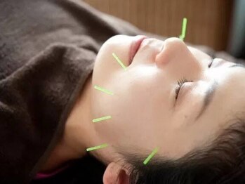 ほりうちケア鍼灸院整骨院の写真/美容鍼で肌のハリや弾力がアップ！しわ、たるみ、くすみ改善。紫外線ケアにも◎