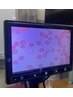 自分のカラダの不調を血液観察で健康状態を知りたい！体験