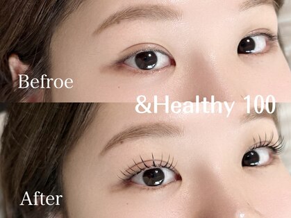 ヴィジョン(vision)の写真