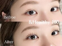 ヴィジョン(vision)