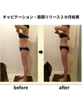 クリア(Clear)/キャビテーション・筋膜リリース