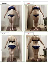 エステティック レイビス 銀座店(RAYVIS)/痩身before＆after