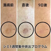 イデアーレ(ideale)