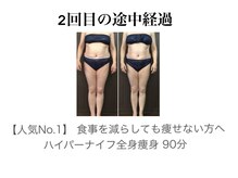 バーテックスキー(Vertexkey)/人気No.1