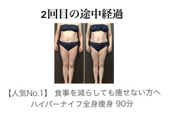 バーテックスキー(Vertexkey)/人気No.1