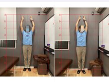 摂津本山駅前鍼灸整骨院/ビフォーアフターになります！