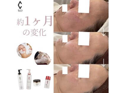 ミミルーチェ(mimiluce)の写真