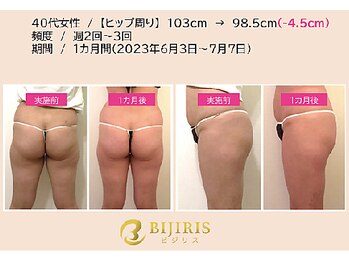 結座 ロータスバリ(Yuiza Lotus Bali)/美尻イス(ビジリス)の効果