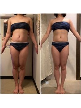骨盤ストレッチ整体 b/骨盤矯正×ハイパーナイフ